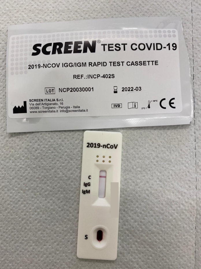 Screen Test Covid-19 CORONAVIRUS