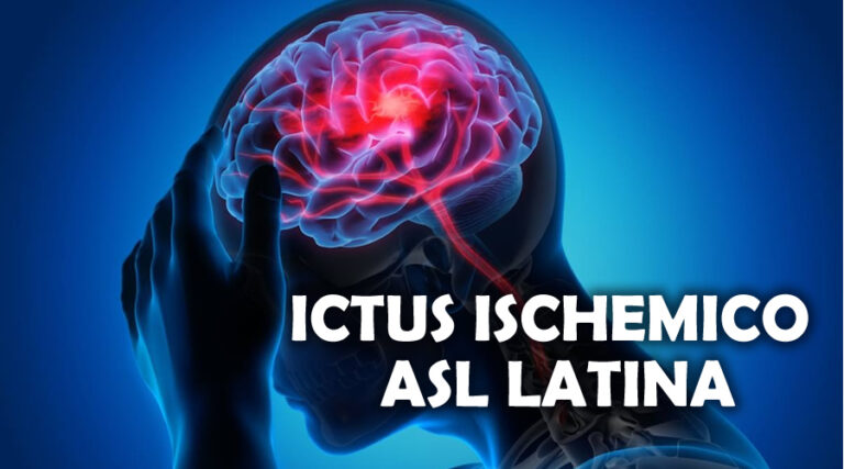 Cura dell’Ictus Ischemico nell’ASL di Latina