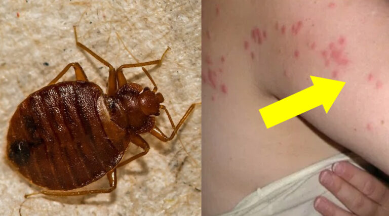 Cimici dei letti: dove si trovano e come difendersi