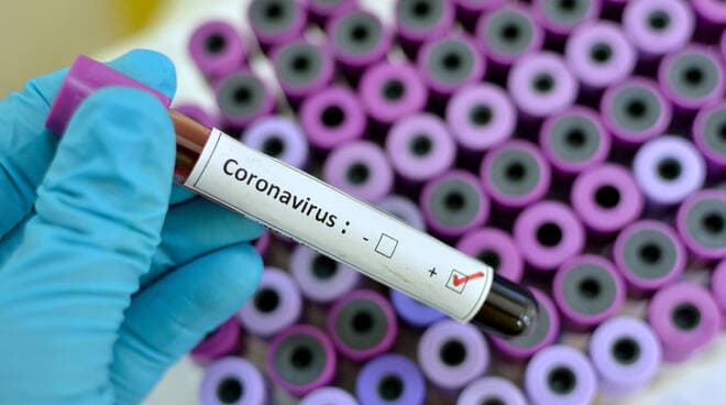+++ CORONAVIRUS - DUE NUOVI CASI A FONDI +++