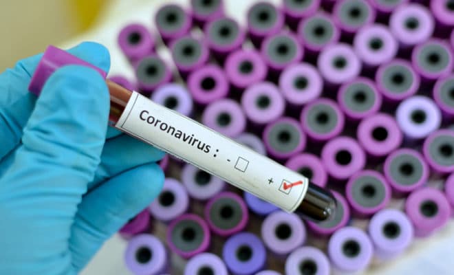 CORONAVIRUS: ASL COMUNICA QUATTRO COMUNI PONTINI CON NUOVI SETTE CASI DI CONTAGIO