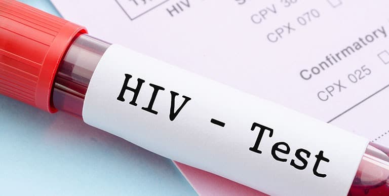 1 Dicembre, Giornata Mondiale contro l'HIV/AIDS