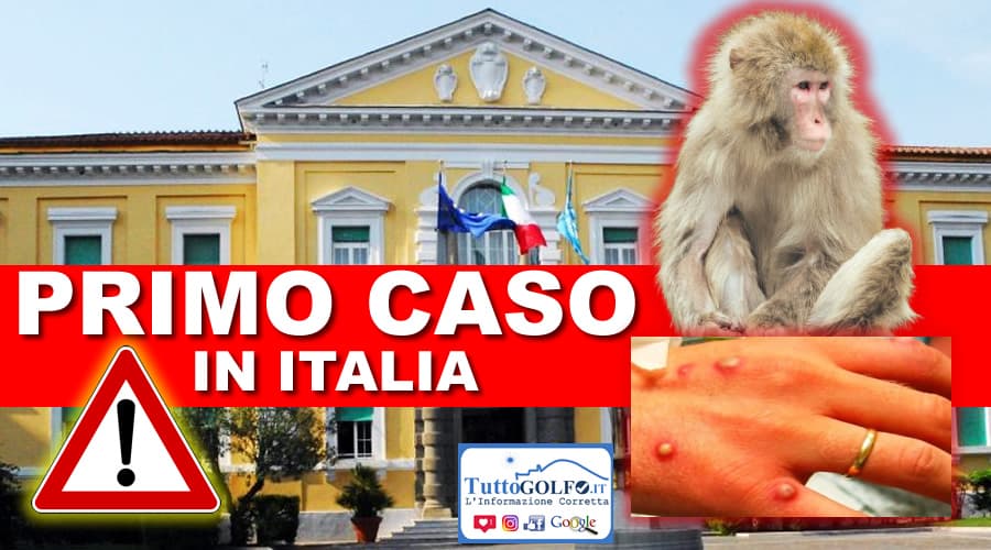 Vaiolo delle Scimmie: Primo caso in Italia