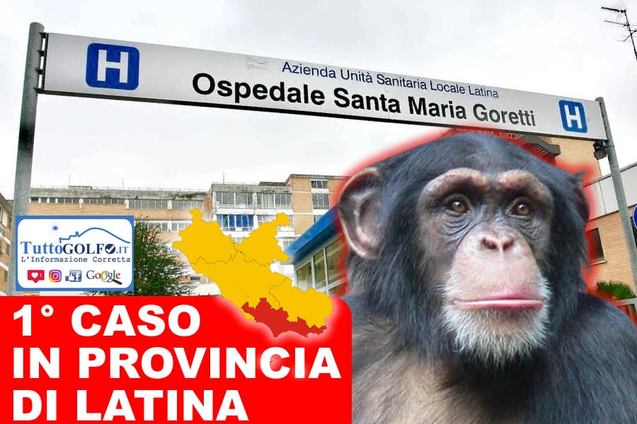 PRIMO CASO in provincia di Latina di Vaiolo delle Scimmie