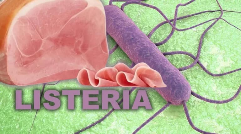 Possibile presenza di Listeria in un prosciutto cotto