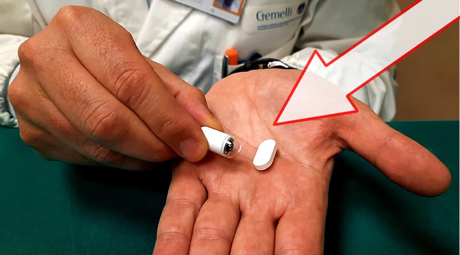 Gastroscopia senza tubo al Gemelli di Roma. Tra qualche anno assisteremo ad una rivoluzione in ambito medico