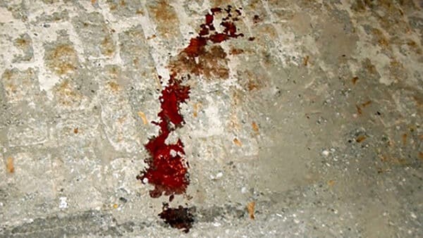 Rinvenuto 18enne riverso a terra e sanguinante, con evidenti segni di percosse e ferite. Trasporto in codice rosso