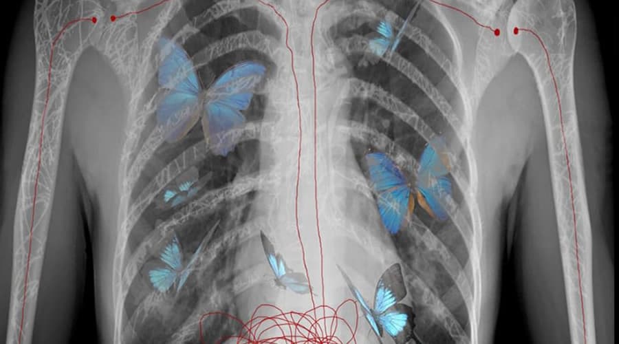 Formia - Rib Cage: Esplorazioni dell'Anima