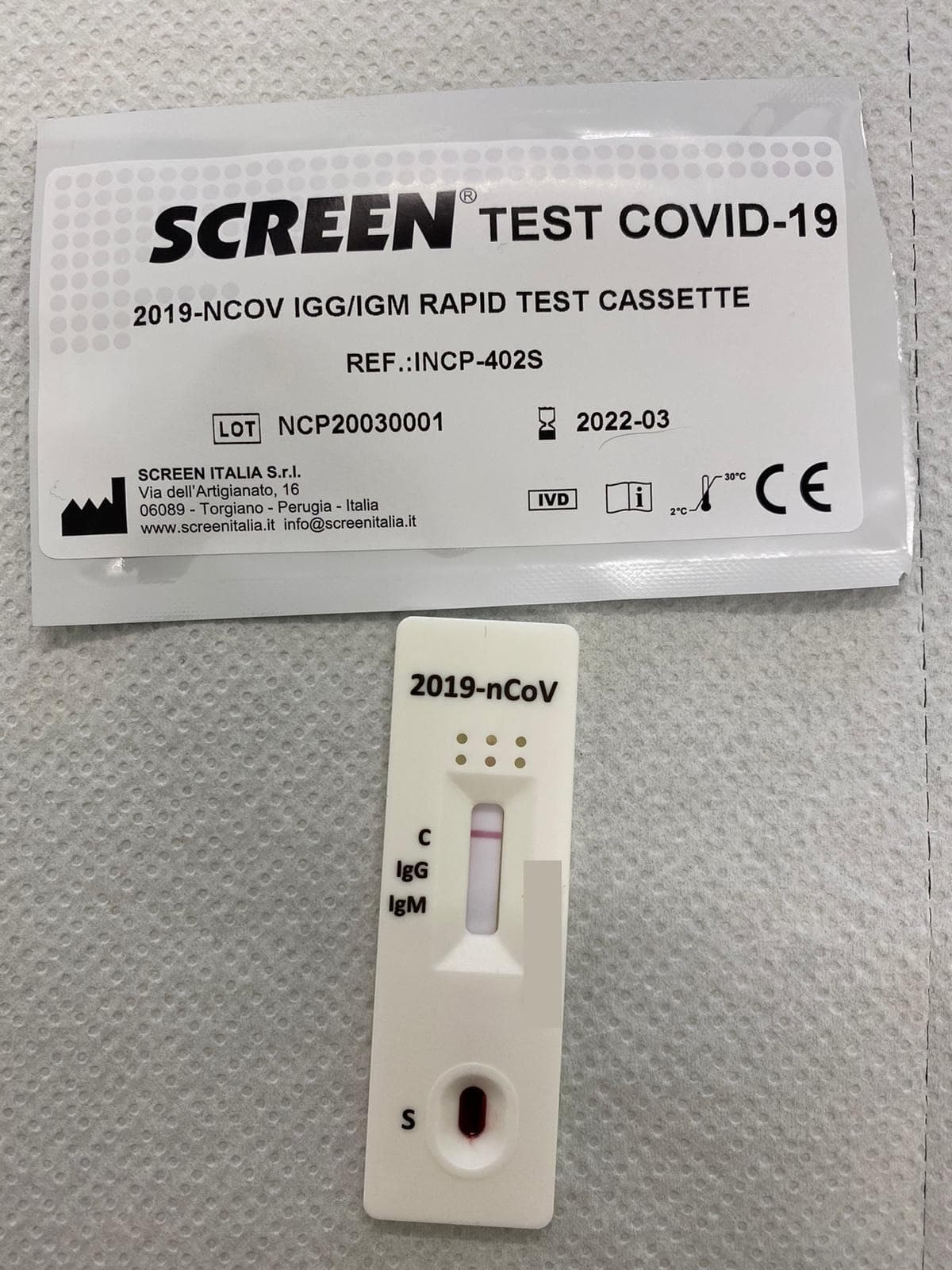 COVID-19: ARCURI INTERVIENE SU TEST SIEROLOGICI, CONTACT TRACING E TAMPONI