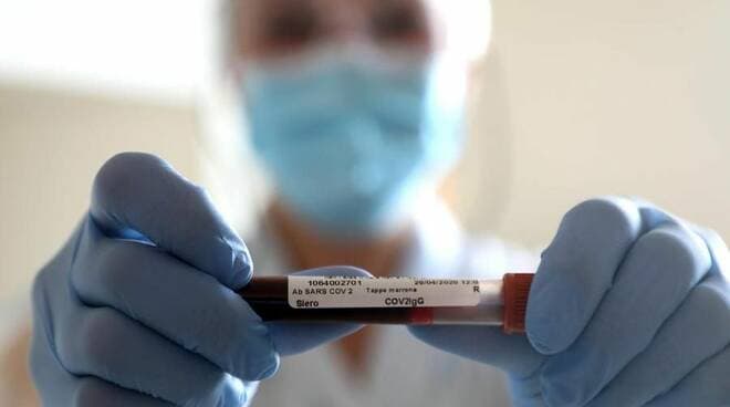 Gaeta. Test sierologici gratuiti: il Sindaco, l'Assessore alla Sanità e il Presidente della Commissione Sanità spiegano l'iniziativa