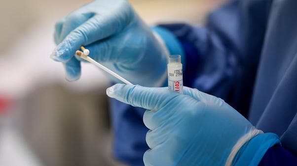 ISTITUTO SUPERIORE DI SANITA' - GLI ANTICORPI ANTI SARS-COV-2 EVIDENZIANO LONGEVITA'