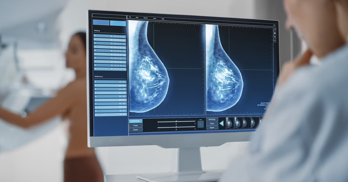 Regione Lazio - Inaccettabile, per una mammografia, attendere un anno
