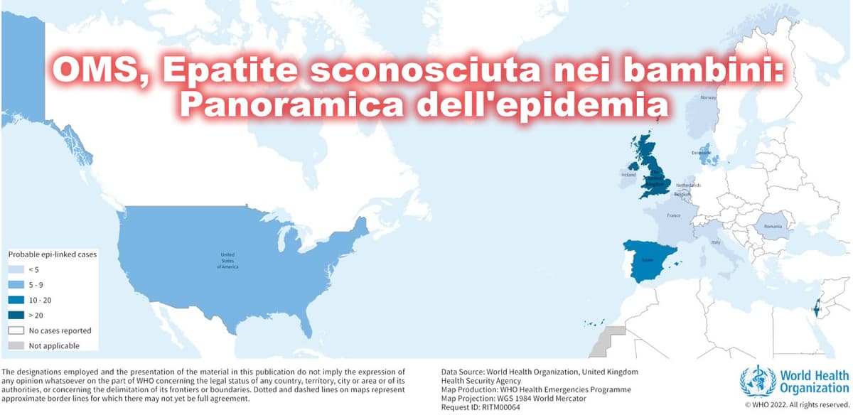 OMS, Epatite di origine sconosciuta nei bambini: Panoramica dell'epidemia