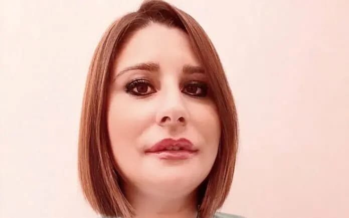 Sara Zuber: Medico Specialista in Dermatologia e Venereologia