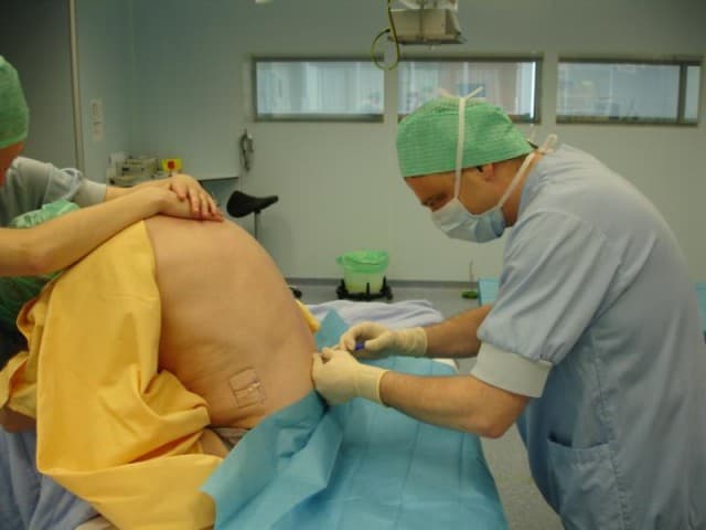 ASL non fornisce in provincia di Latina servizio epidurale alle donne che debbono partorire