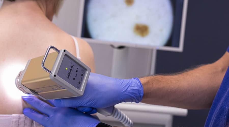 Prevenzione Melanoma: Anni di attesa per l'epiluminescenza