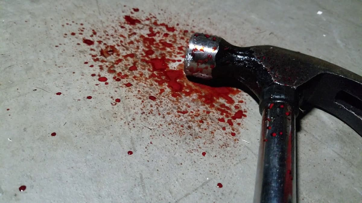Arrestato un uomo, responsabile del tentato omicidio della compagna. L'ha colpita ripetutamente in testa con un martello