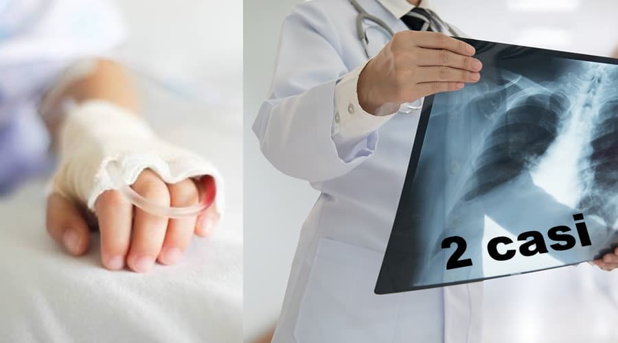 Polmonite bambini causata da Mycoplasma. Due casi segnalati in Italia