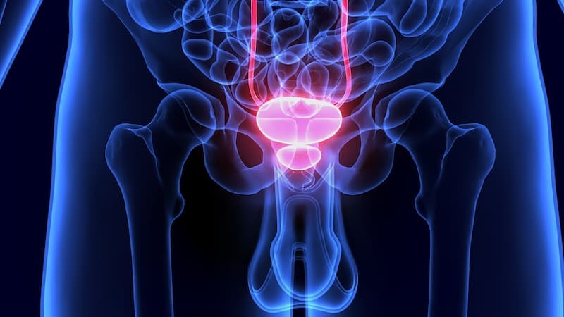 Tumore alla prostata, rivoluzione nella diagnosi con il test delle urine