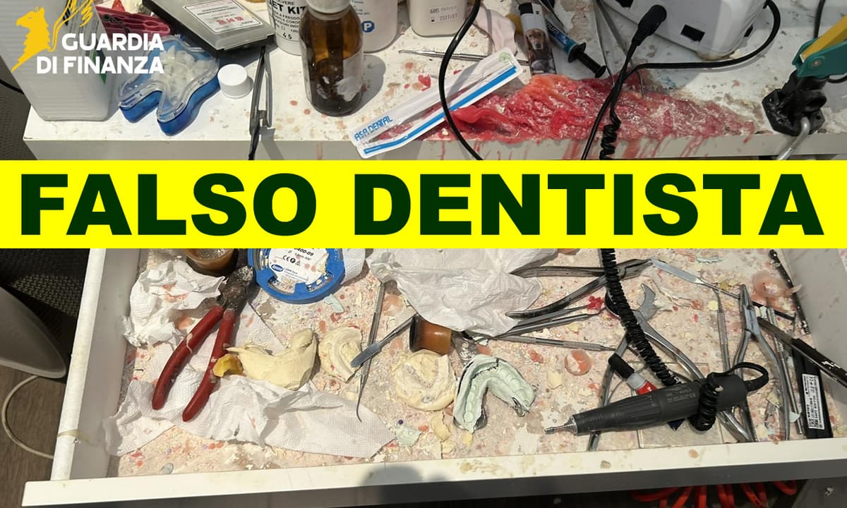 DENUNCIATO FALSO DENTISTA. SCOPERTO E SOTTOPOSTO A SEQUESTRO STUDIO ODONTOIATRICO ABUSIVO