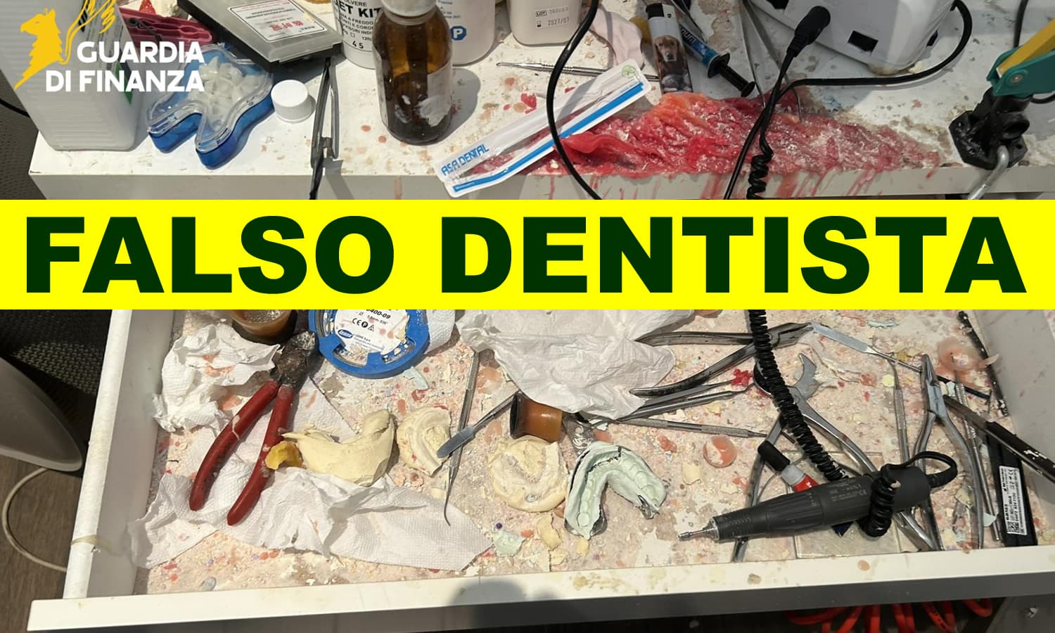 DENUNCIATO FALSO DENTISTA. SCOPERTO E SOTTOPOSTO A SEQUESTRO STUDIO ODONTOIATRICO ABUSIVO
